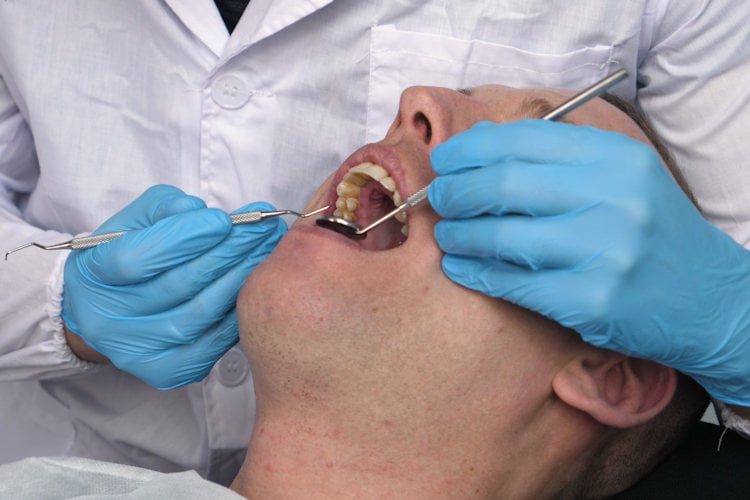 Tandartsen nemen snoeiharde maatregelen tegen niet-flossende patiënt